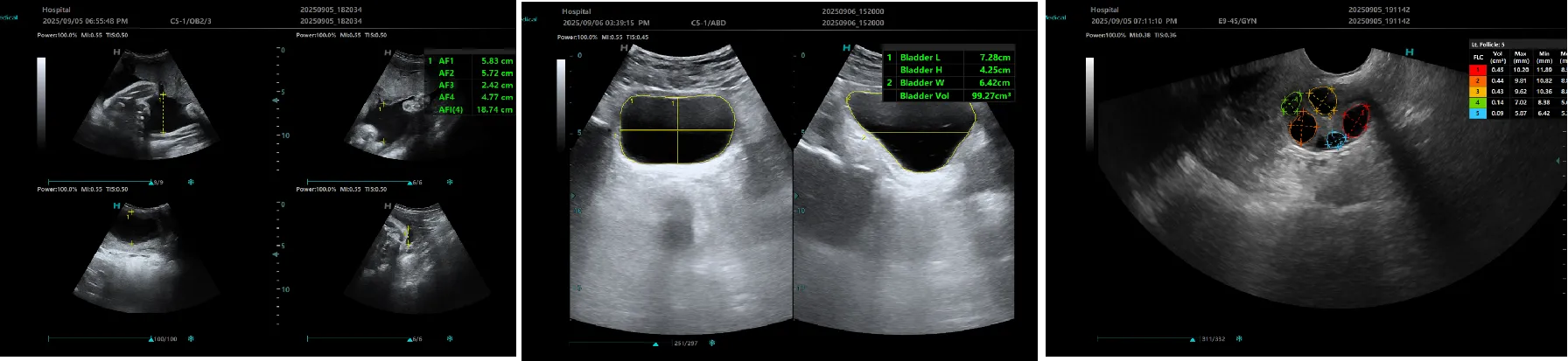 aisense-ultrasound-1